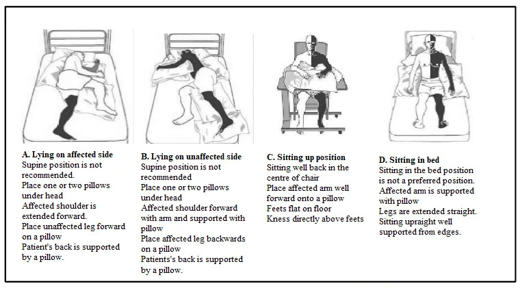 Bed-positioning-for-Hemiplagic-patient