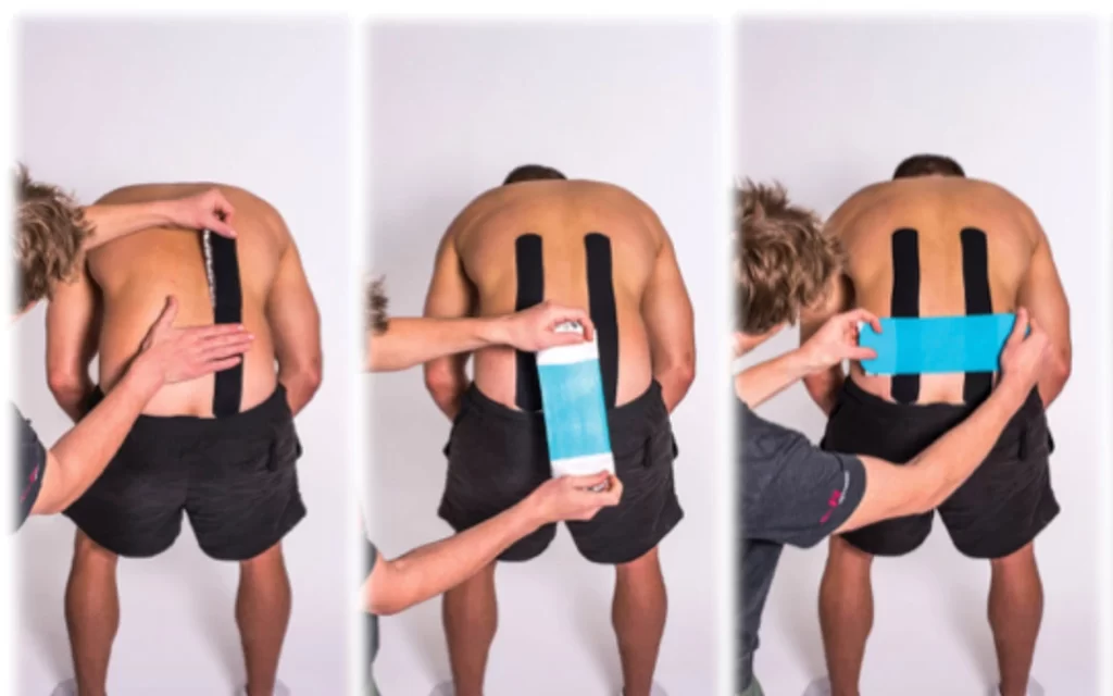 Kt-tape-for-back-pain