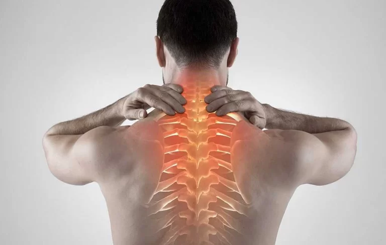 UPPER BACK PAIN