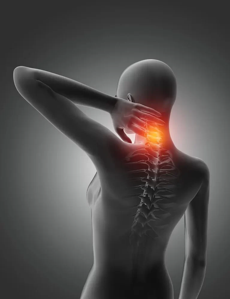 Neck Pain - cervical spondylosis