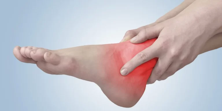 Ankle Pain