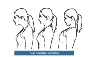 Neck Retraction