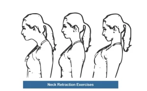Neck-retraction-exercise