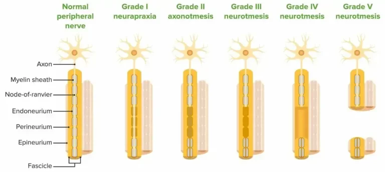 Peripheral Nerve Injury Classifications