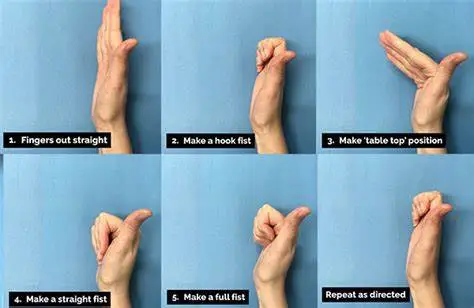 Tendon Glide Exercise for hand