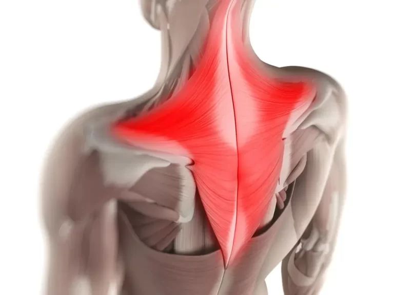 Trapezius Muscle