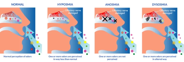 Olfactory-Nerve-Disorders