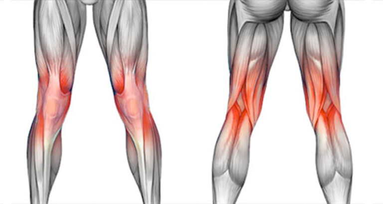 Semimembranosus Tendinopathy