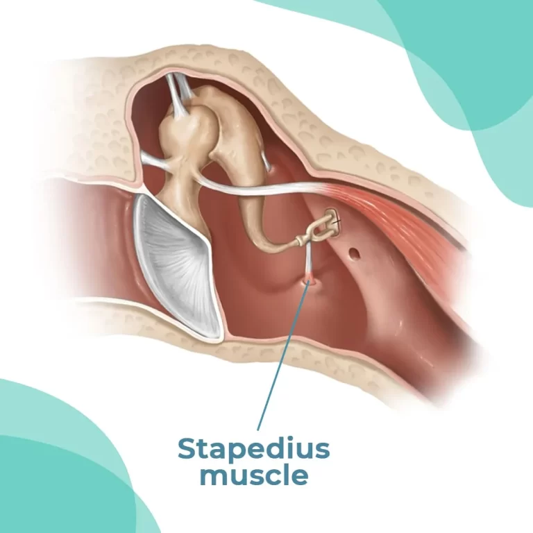 Stapedius Muscle