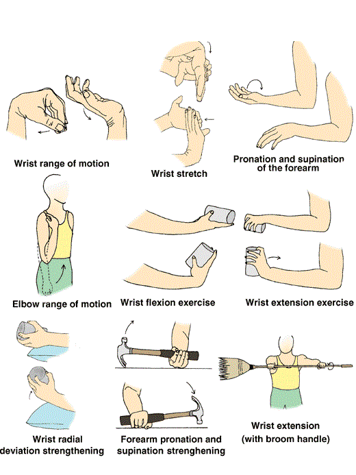 Lateral epicondylitis treatment Exercise