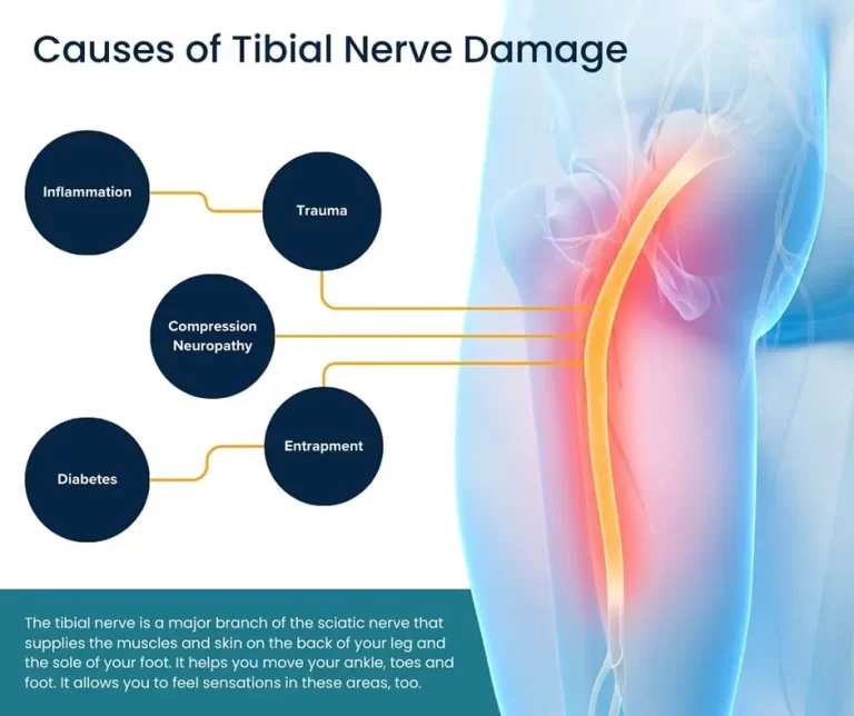 Tibial Nerve Dysfunction