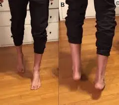 Tip-toe walk exercise