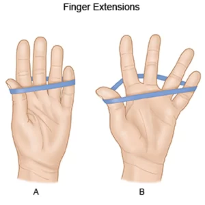 finger-extension-exercise