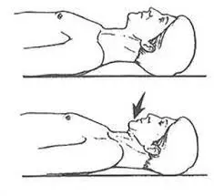 supine chin tuck exercise