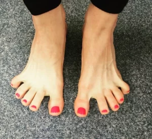 toe splay exercise