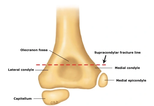 Anatomy of Supracondylar Humerus