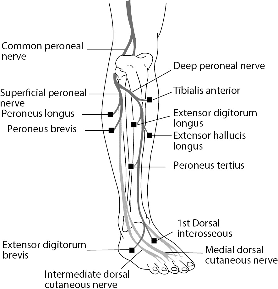 Common peroneal nerve