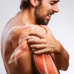 Deltoid-muscle-pain