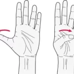 Thumb Flexion