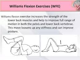 Williams flexion exercise