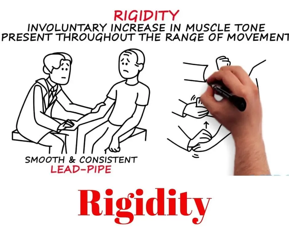 Rigidity