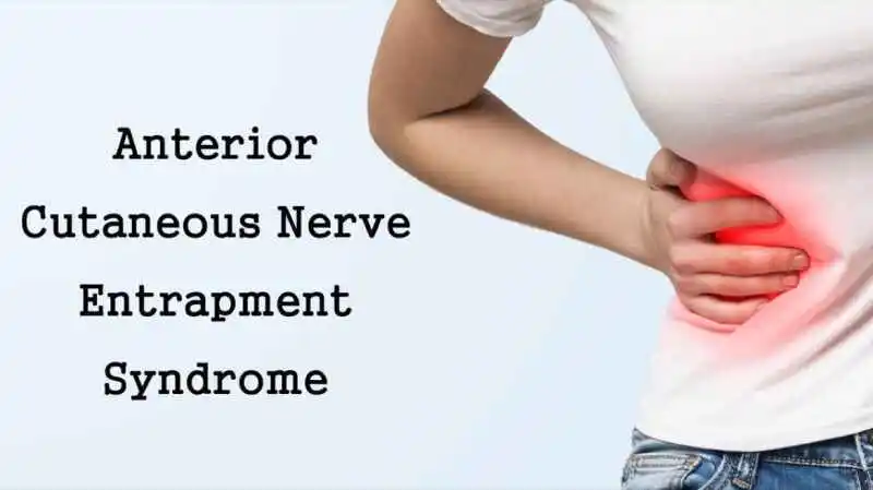 Anterior-Cutaneous-Nerve-Entrapment-Syndrome