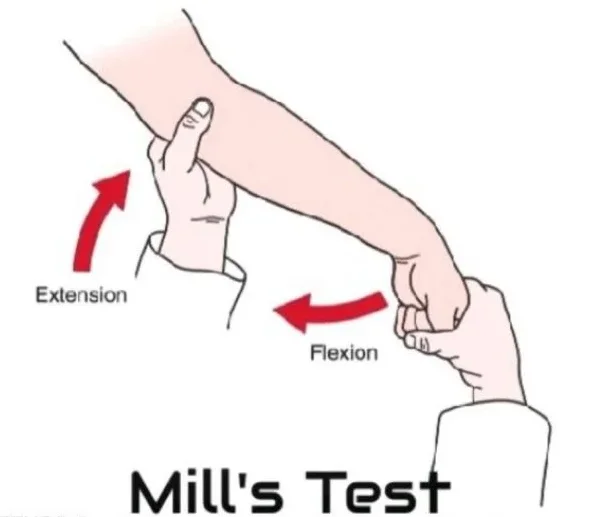 Mill's Test