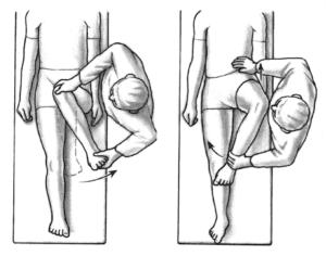 Active-assisted hip internal rotation