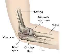 Elbow-joint