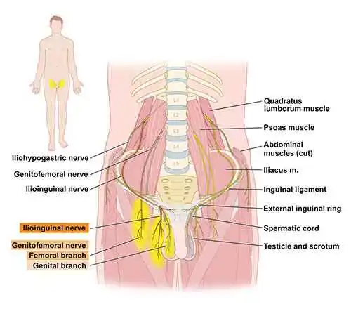 Genitofemoral-Neuralgia