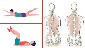 exercise-for-scoliosis