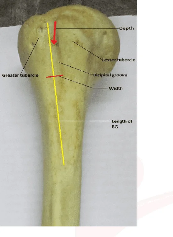 Bicipital Groove