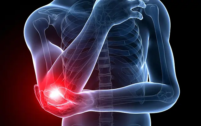 Elbow Joint Stiffness - Cause, Symptoms, Treatment, Exercise