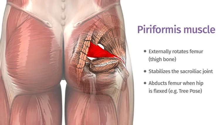 Piriformis Syndrome