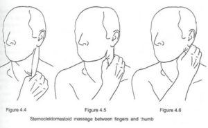 Self massage sternocleidomastoid (SCM)