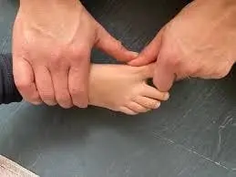 Exercise for Hallux Valgus