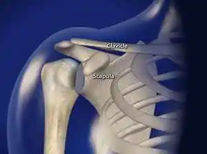 Shoulder-Subluxation