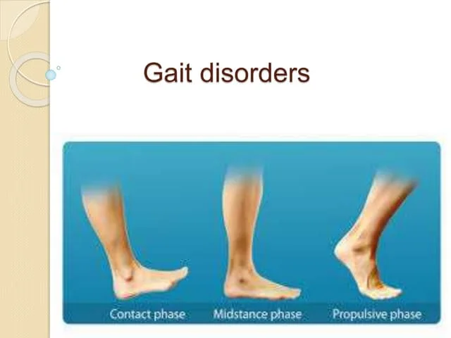 Propulsive Gait