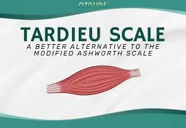 Tardieu Scale