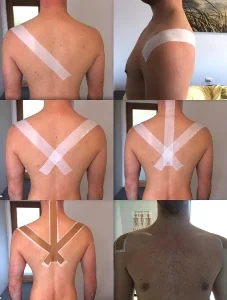 postural correction by taping