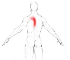 Rhomboid Muscle Pain