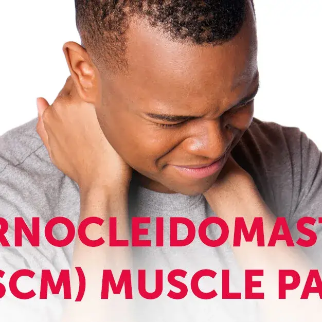 Sternocleidomastoid Muscle Pain