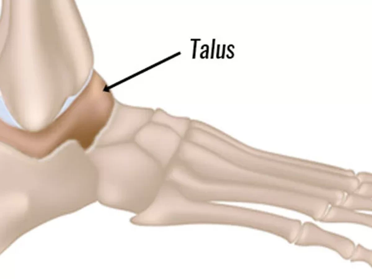 Talus Bone