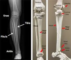 Tibia