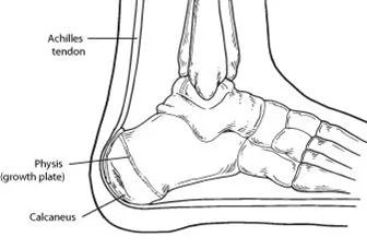 Calcaneus