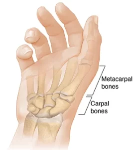 Read more about the article Carpometacarpal Joint