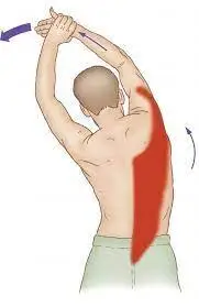 Latissimus Dorsi Muscle Pain