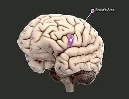 Broca’s Aphasia