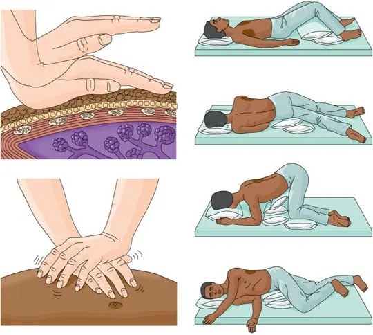 Chest-physiotherapy 