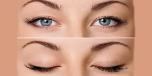 Continue blinking eye exercise